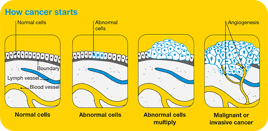 saintis jepun membuktikan berpuasa dapat mencegah barah